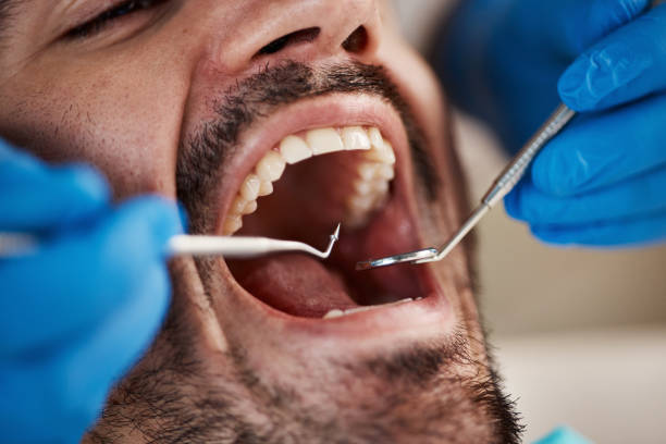 Best Root Canal Emergency Dentist  in Concord, VA